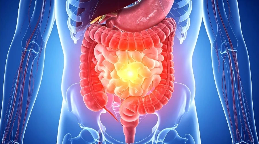 Les pathologies digestives et extra digestives